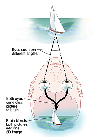 View of eyes and brain from top of head showing how images from both eyes are processed in brain normally.